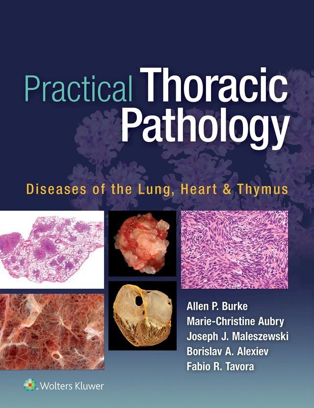  Practical Thoracic Pathology(Kobo/電子書)