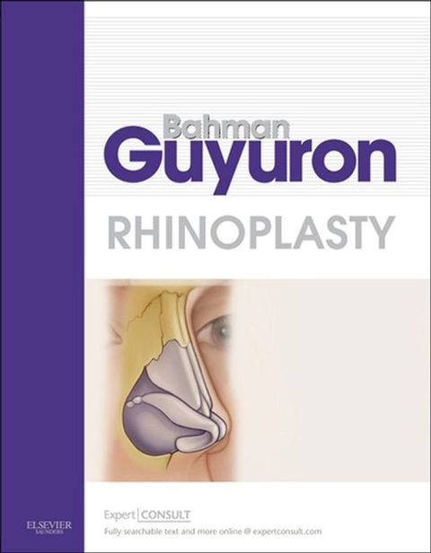 Rhinoplasty E-Book(Kobo/電子書)