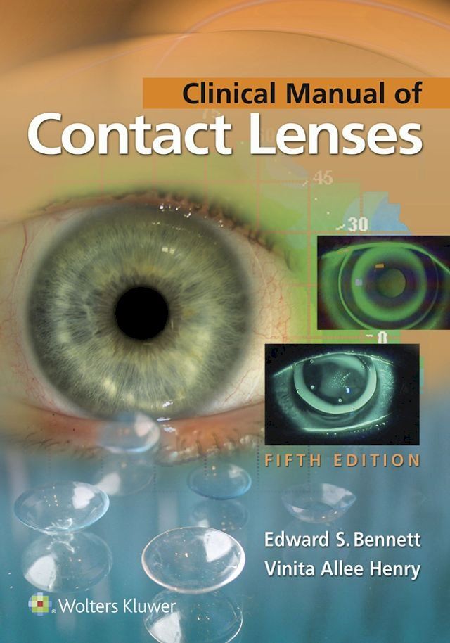  Clinical Manual of Contact Lenses(Kobo/電子書)