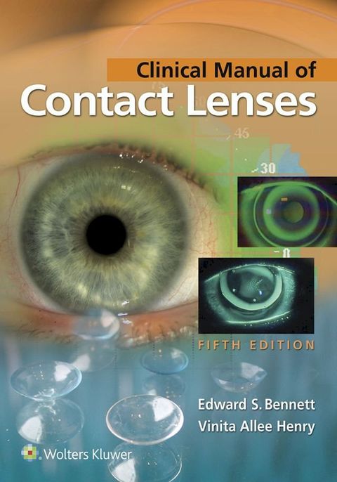 Clinical Manual of Contact Lenses(Kobo/電子書)