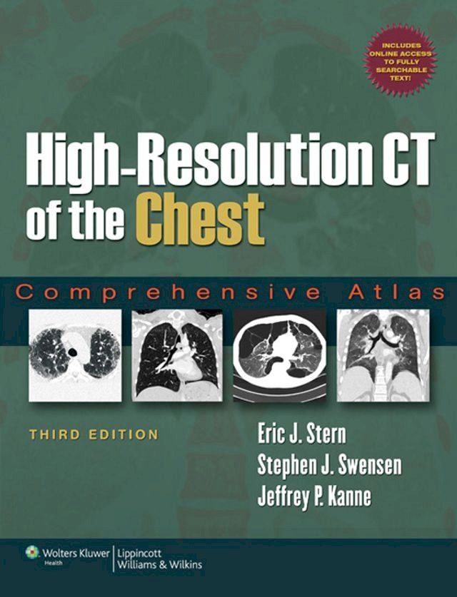  High-Resolution CT of the Chest(Kobo/電子書)