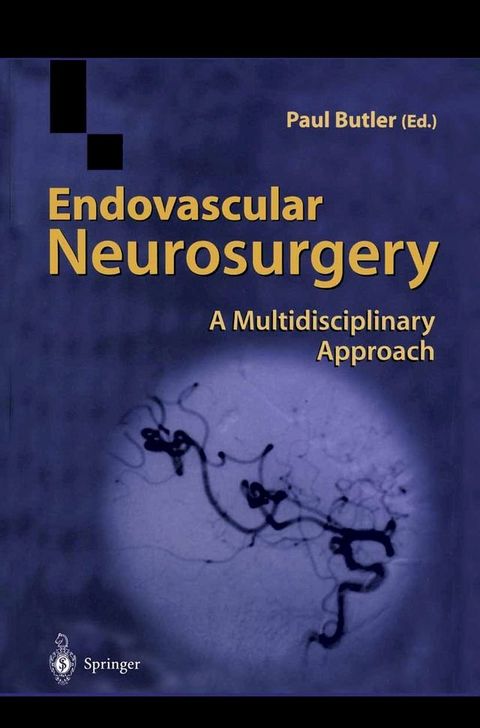 Endovascular Neurosurgery(Kobo/電子書)