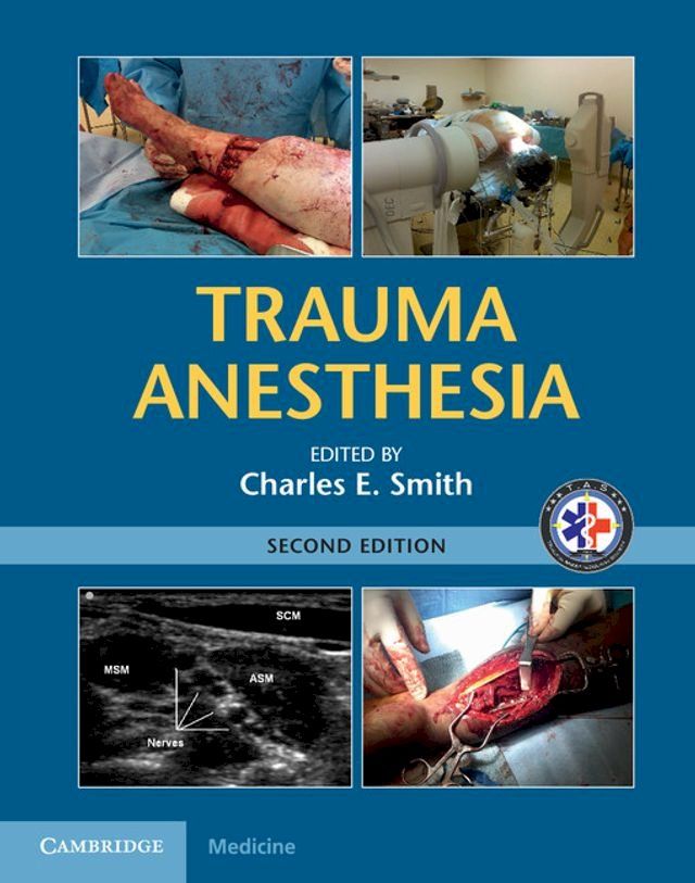  Trauma Anesthesia(Kobo/電子書)