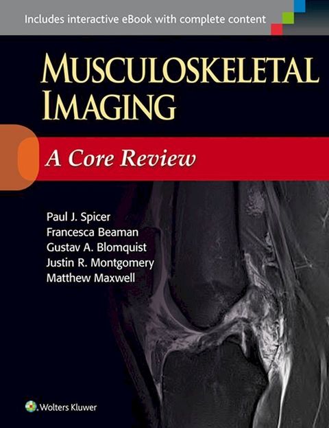 Musculoskeletal Imaging: A Core Review(Kobo/電子書)