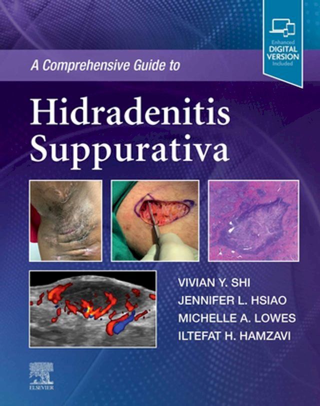  A Comprehensive Guide to Hidradenitis Suppurativa(Kobo/電子書)