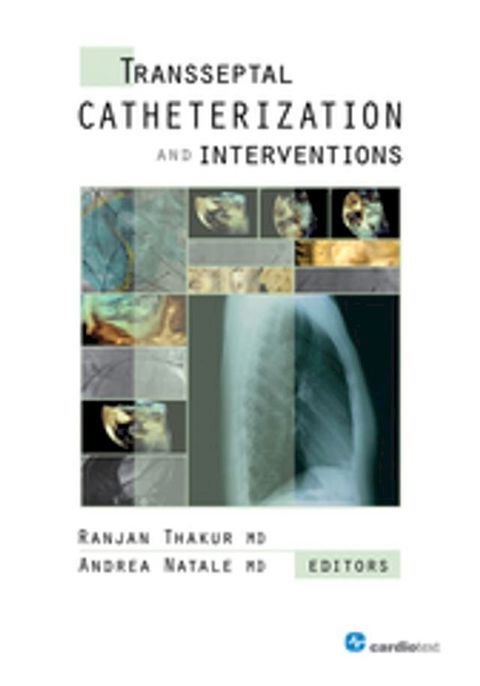 Transseptal Catheterization and Interventions(Kobo/電子書)