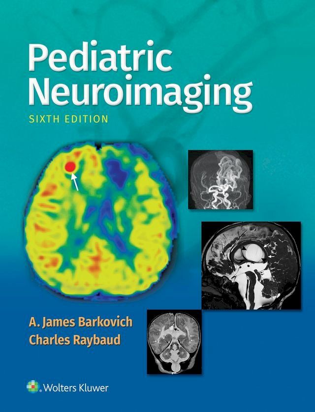  Pediatric Neuroimaging(Kobo/電子書)