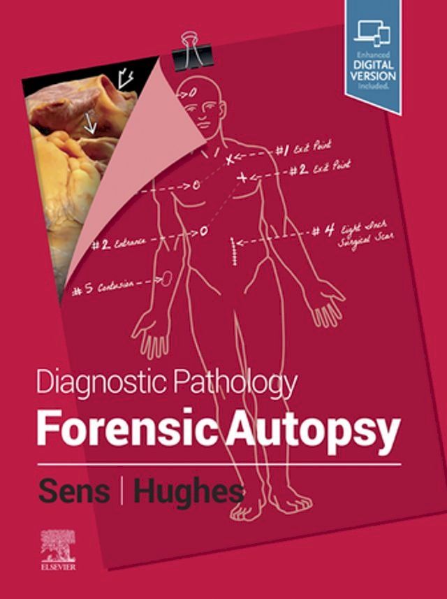  Diagnostic Pathology: Forensic Autopsy E-Book(Kobo/電子書)