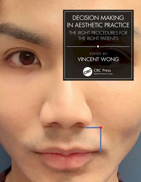 Decision Making in Aesthetic Practice(Kobo/電子書)