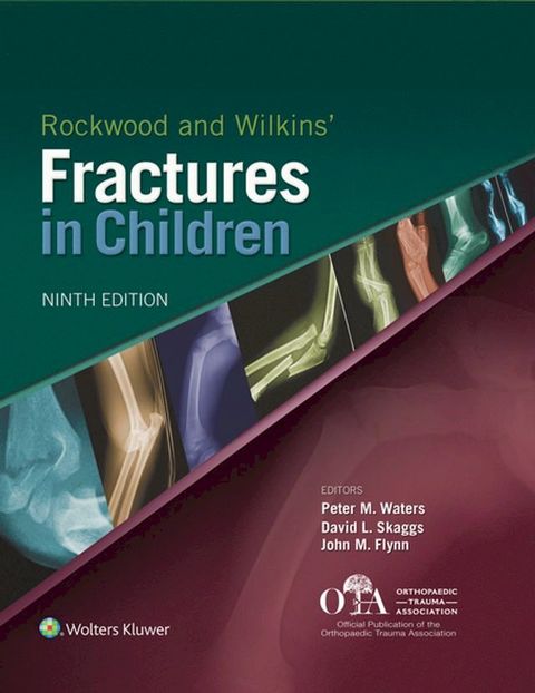 Rockwood and Wilkins Fractures in Children(Kobo/電子書)