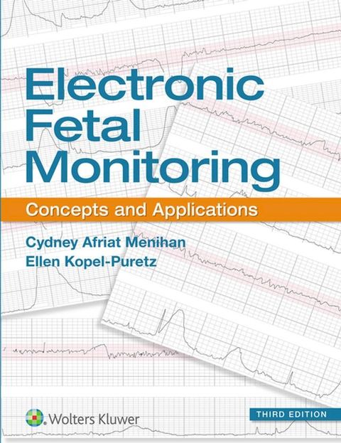 Electronic Fetal Monitoring(Kobo/電子書)