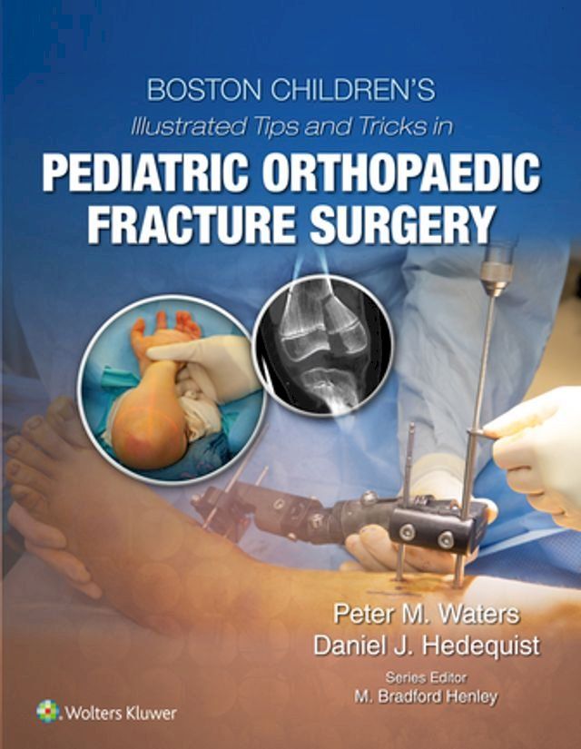  Boston Children’s Illustrated Tips and Tricks in Pediatric Orthopaedic Fracture Surgery(Kobo/電子書)