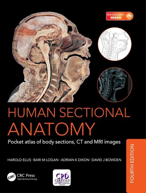 Human Sectional Anatomy(Kobo/電子書)