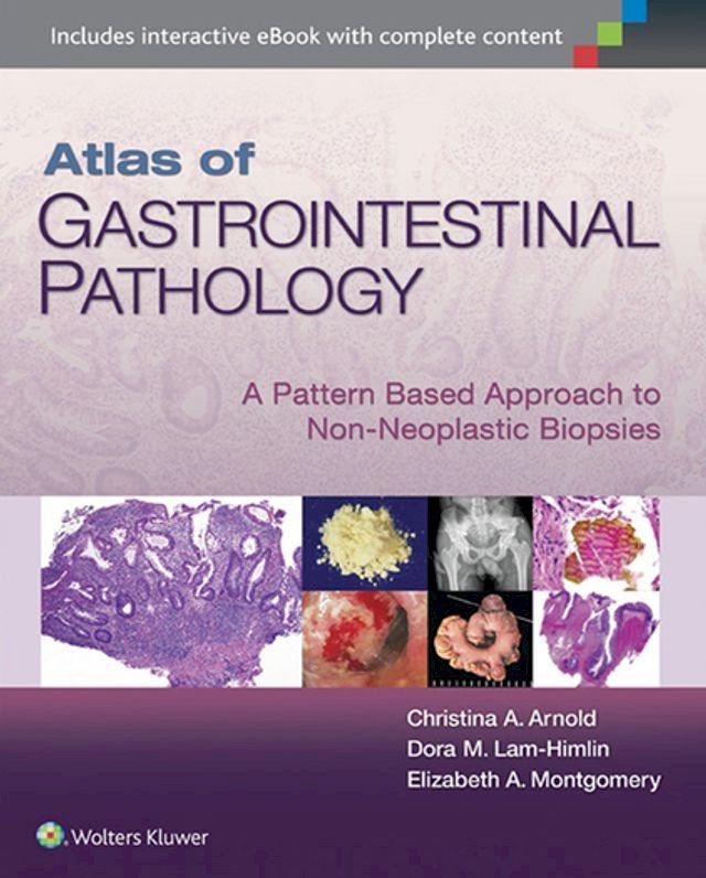  Atlas of Gastrointestinal Pathology(Kobo/電子書)