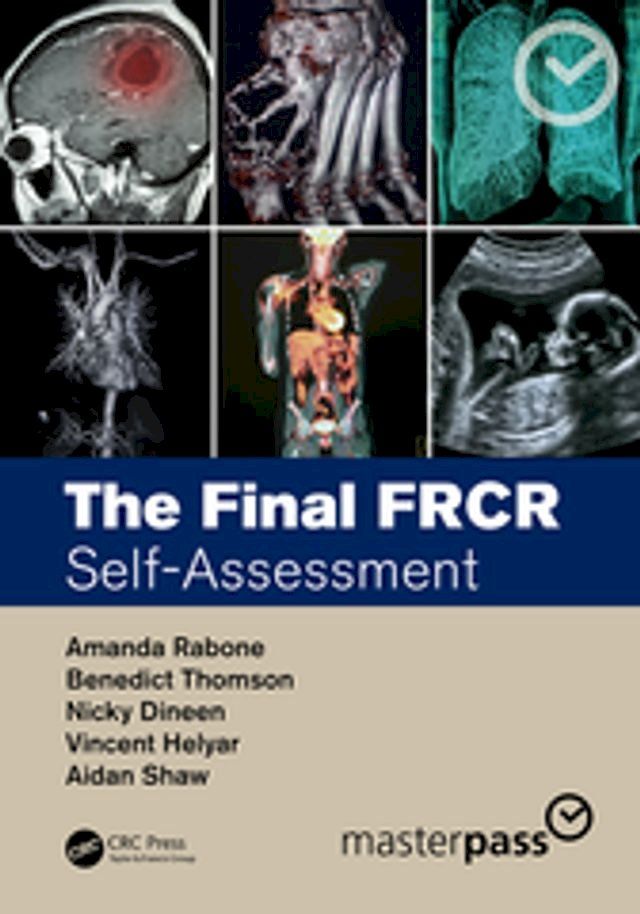  The Final FRCR(Kobo/電子書)