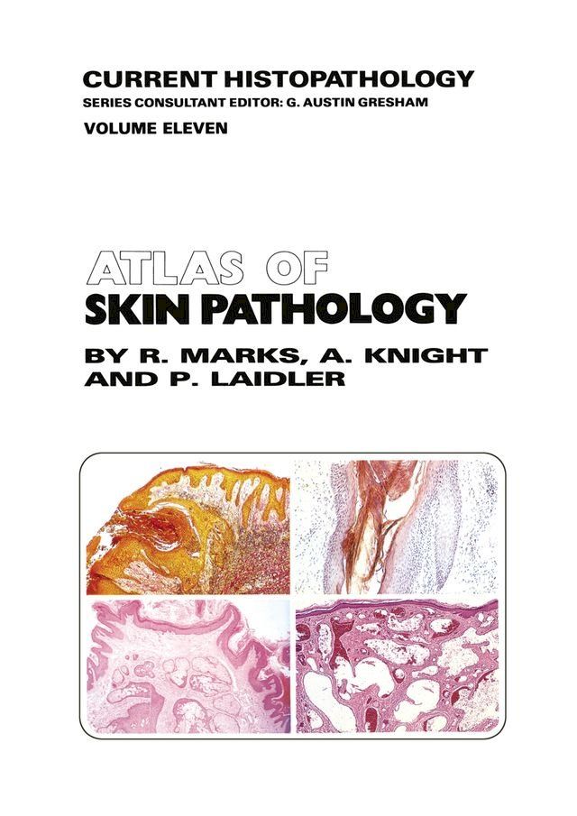  Atlas of Skin Pathology(Kobo/電子書)