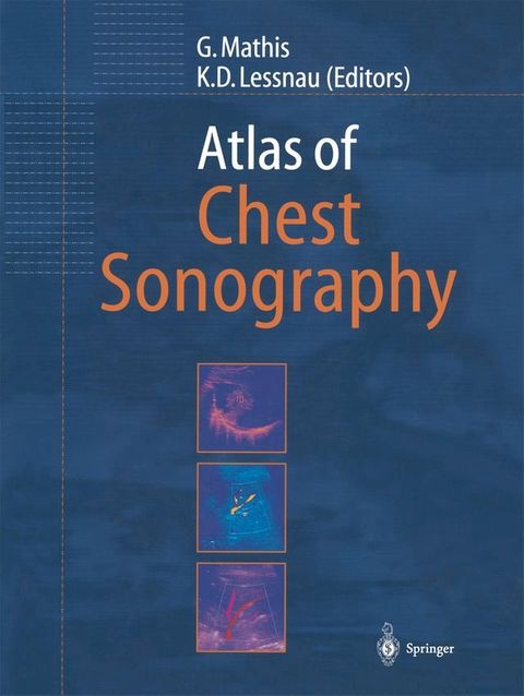 Atlas of Chest Sonography(Kobo/電子書)