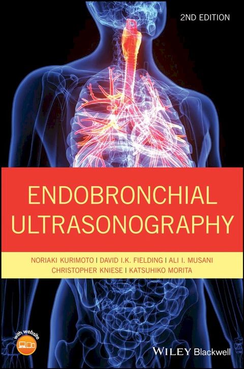 Endobronchial Ultrasonography(Kobo/電子書)