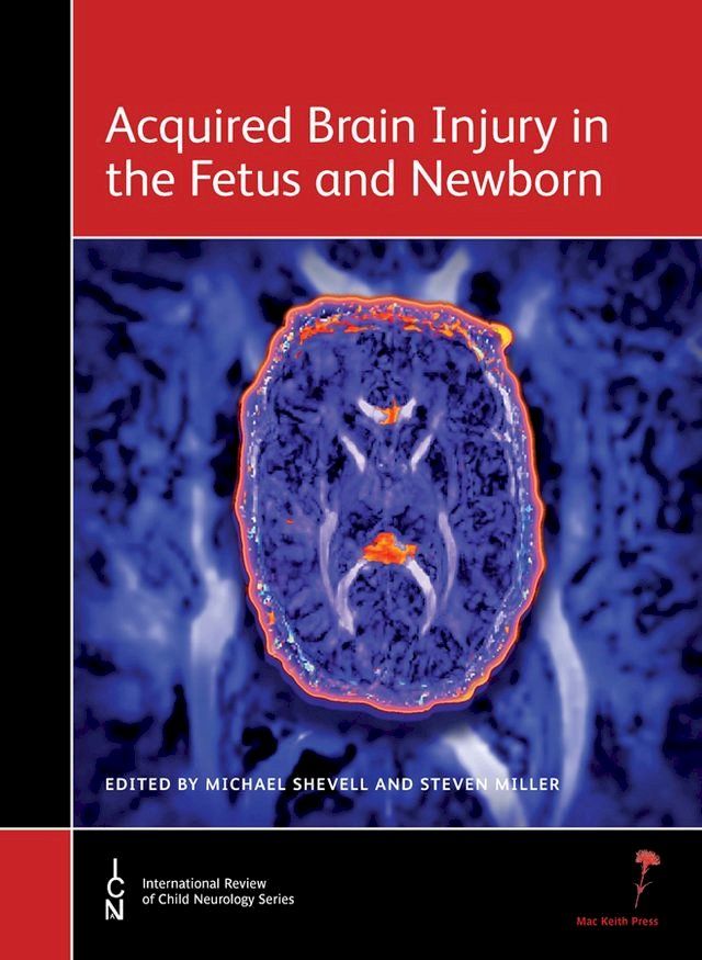  Acquired Brain Injury in the Fetus and Newborn(Kobo/電子書)