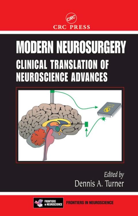 Modern Neurosurgery(Kobo/電子書)