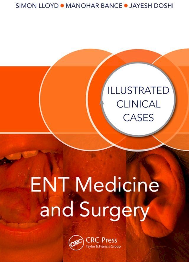  ENT Medicine and Surgery(Kobo/電子書)