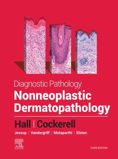 Diagnostic Pathology: Nonneoplastic Dermatopathology(Kobo/電子書)