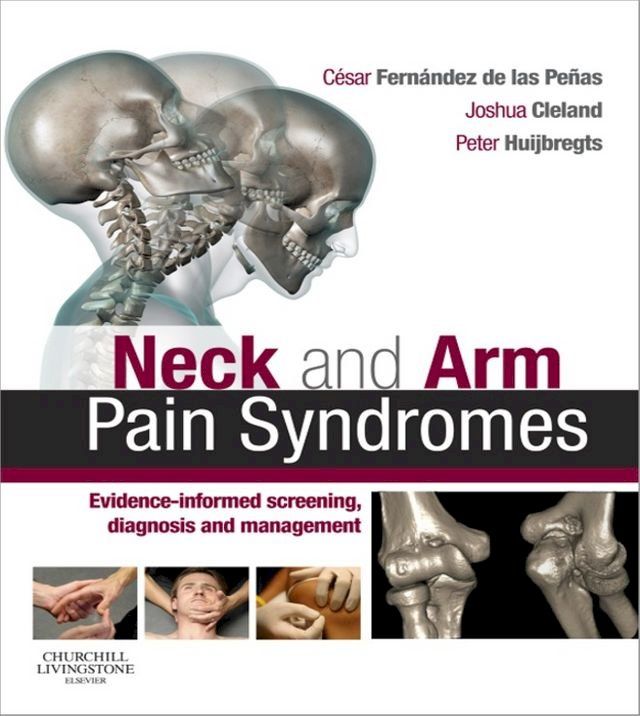  Neck and Arm Pain Syndromes E-Book(Kobo/電子書)