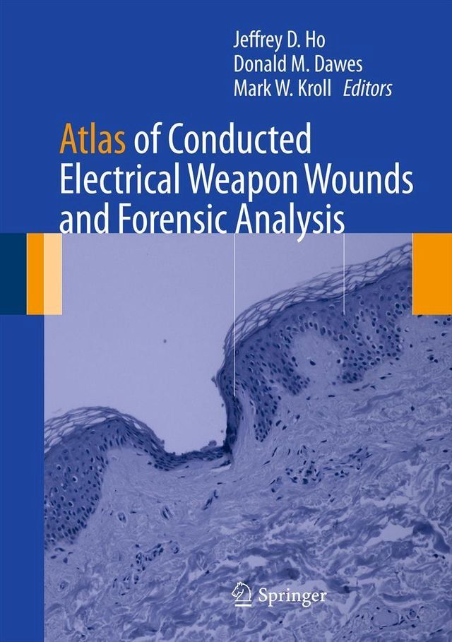  Atlas of Conducted Electrical Weapon Wounds and Forensic Analysis(Kobo/電子書)