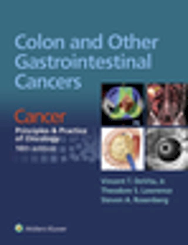  Colon and Other Gastrointestinal Cancers(Kobo/電子書)