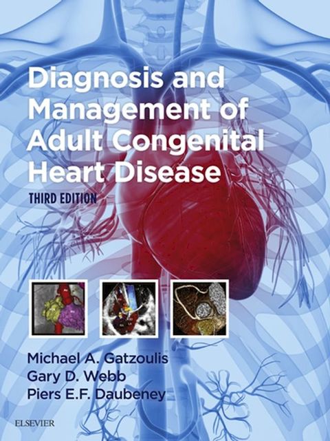 Diagnosis and Management of Adult Congenital Heart Disease(Kobo/電子書)