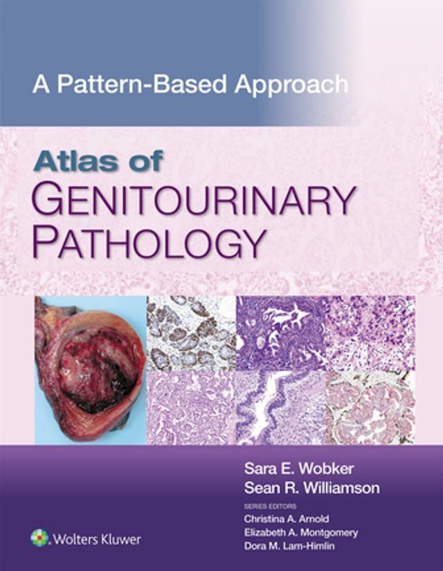  Atlas of Genitourinary Pathology(Kobo/電子書)