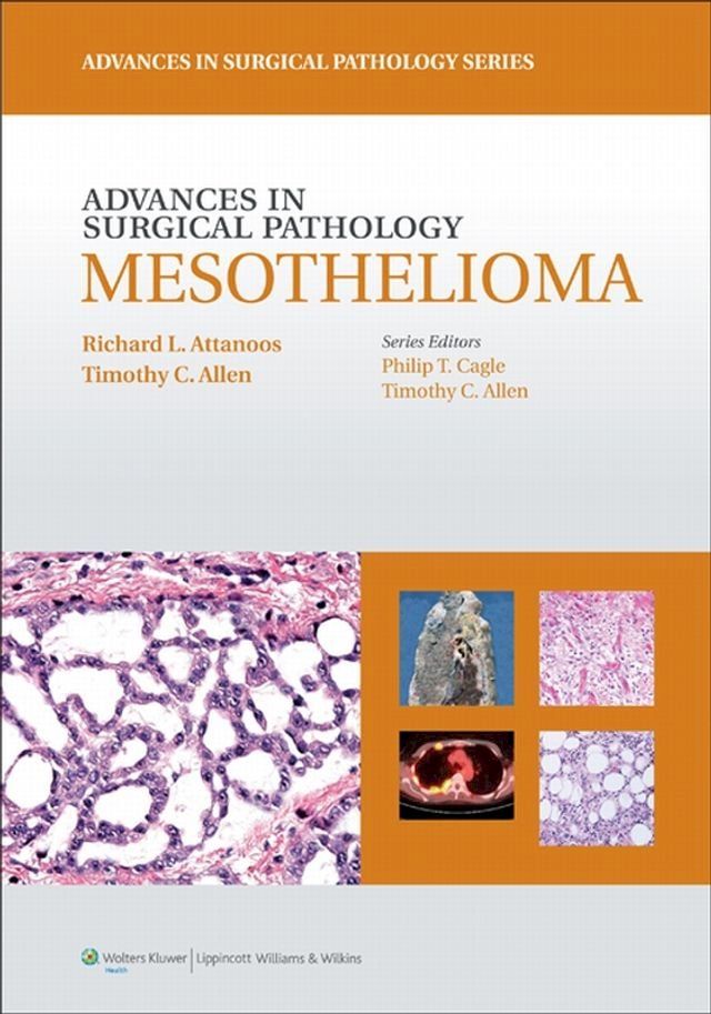  Advances in Surgical Pathology: Mesothelioma(Kobo/電子書)