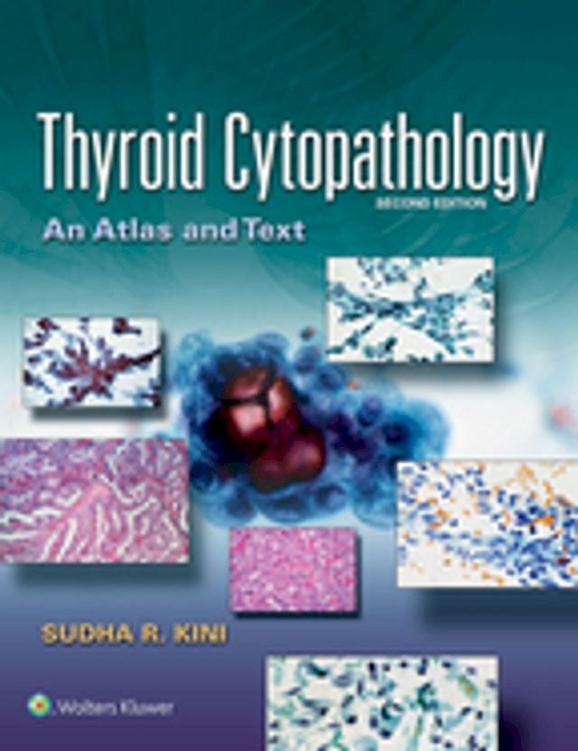  Thyroid Cytopathology(Kobo/電子書)