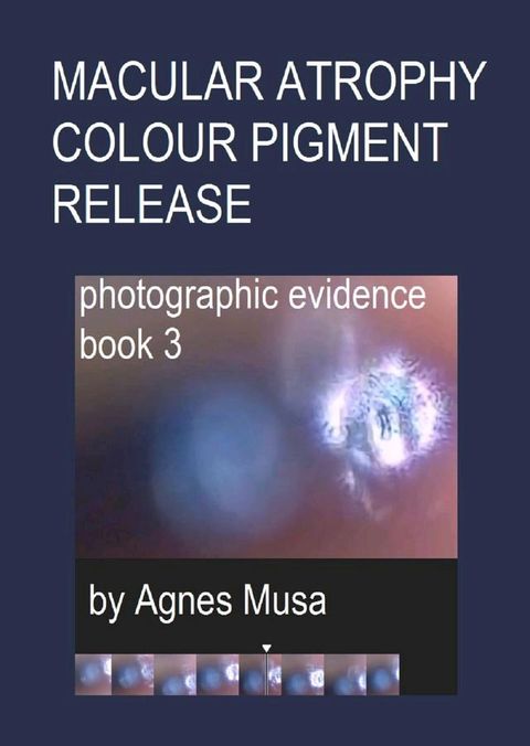 Macular Atrophy Colour Pigment Release, Photographic Evidence Book 3(Kobo/電子書)