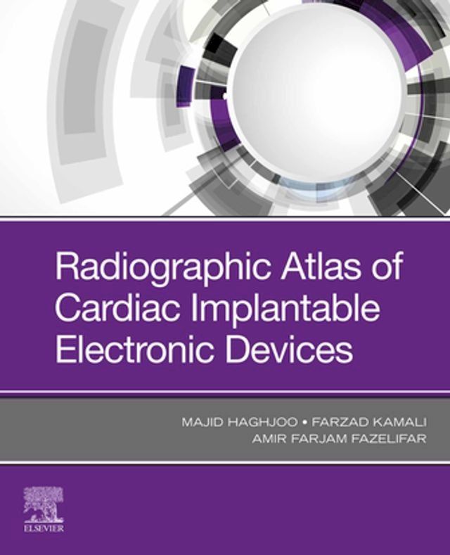  Radiographic Atlas of Cardiac Implantable Electronic Devices - E-Book(Kobo/電子書)