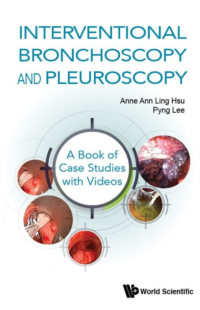  Interventional Bronchoscopy And Pleuroscopy: A Book Of Case Studies With Videos(Kobo/電子書)