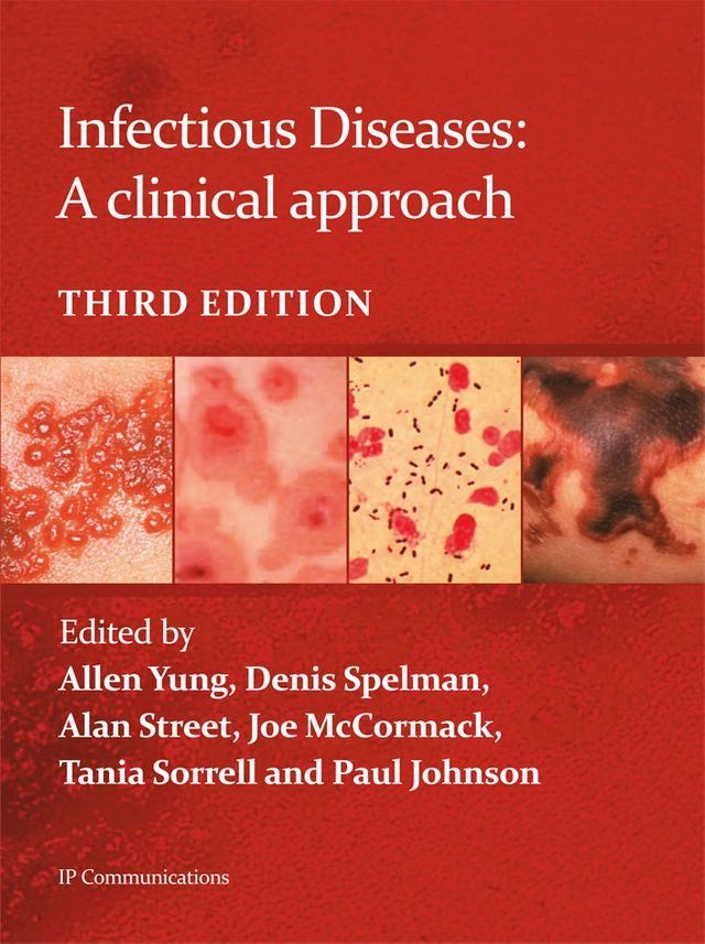  Infectious Diseases: A clinical approach(Kobo/電子書)