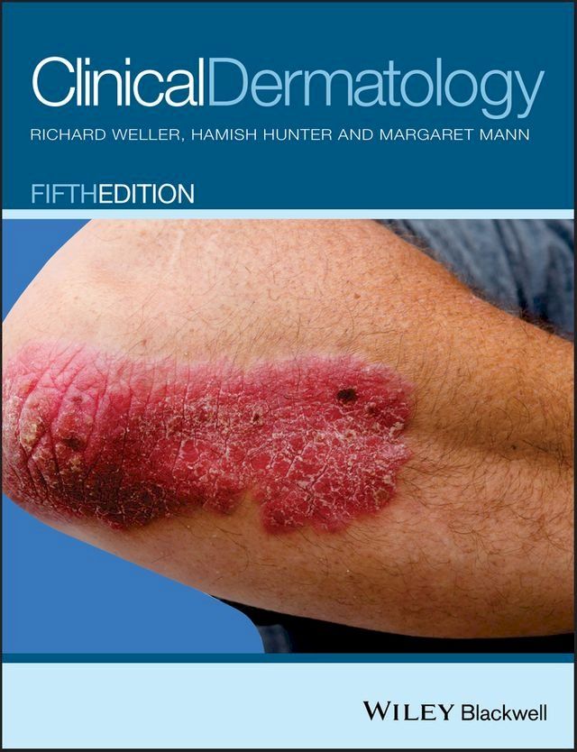  Clinical Dermatology(Kobo/電子書)