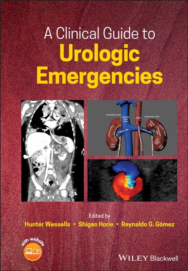  A Clinical Guide to Urologic Emergencies(Kobo/電子書)