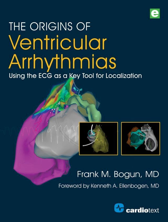  The Origins of Ventricular Arrhythmias(Kobo/電子書)