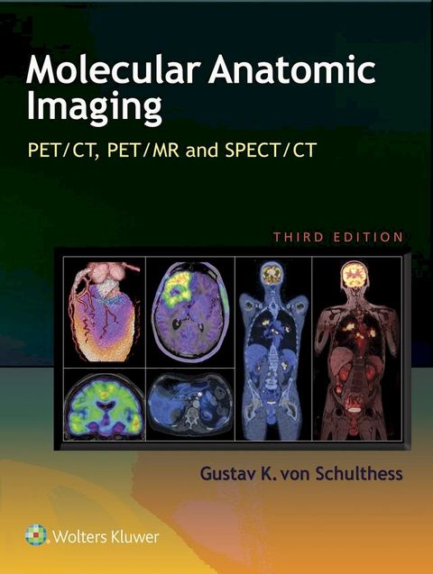 Molecular Anatomic Imaging(Kobo/電子書)