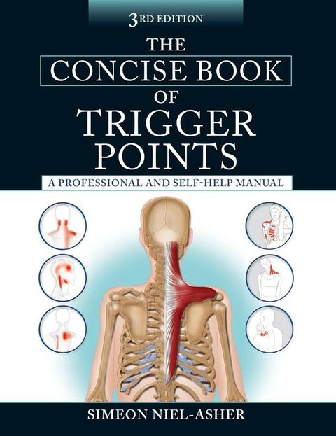 The Concise Book of Trigger Points, Third Edition(Kobo/電子書)