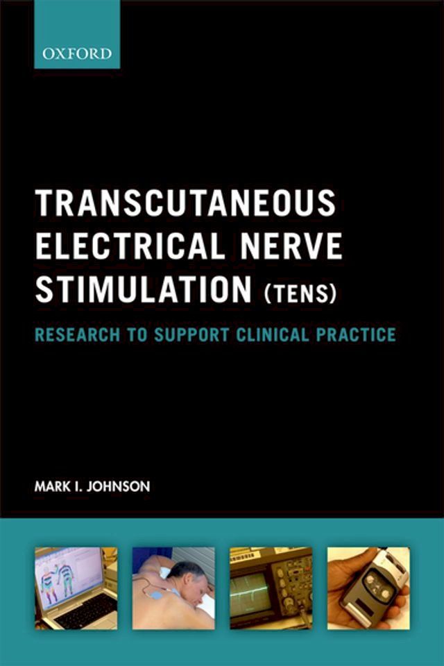  Transcutaneous Electrical Nerve Stimulation (TENS)(Kobo/電子書)