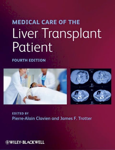 Medical Care of the Liver Transplant Patient(Kobo/電子書)