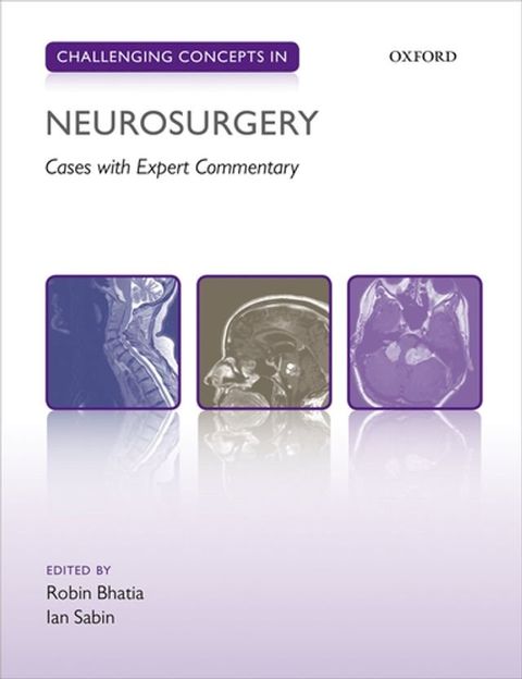 Challenging Concepts in Neurosurgery(Kobo/電子書)