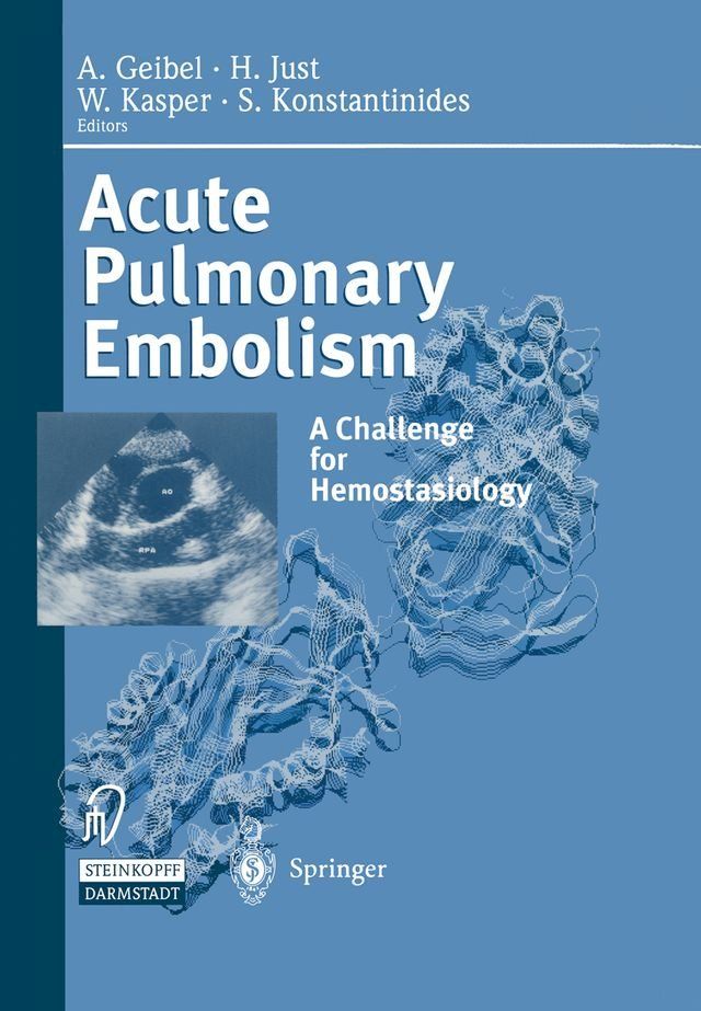  Acute Pulmonary Embolism(Kobo/電子書)