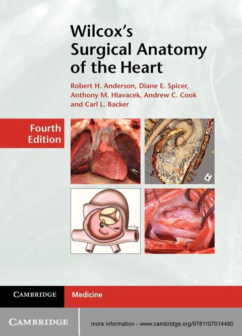 Wilcox's Surgical Anatomy of the Heart(Kobo/電子書)