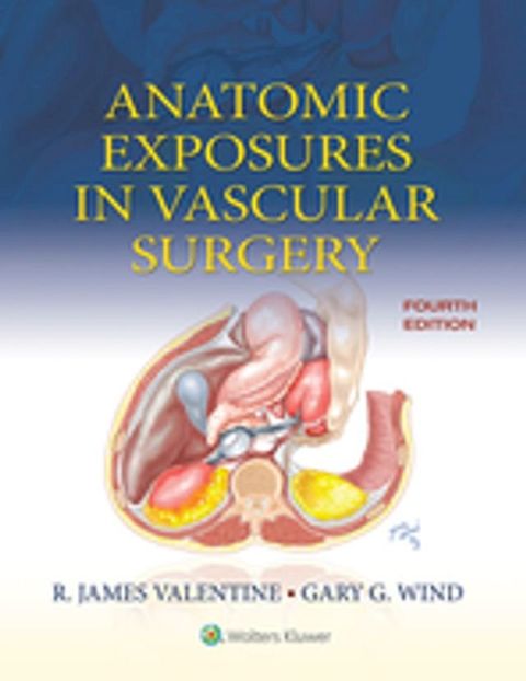 Anatomic Exposures in Vascular Surgery(Kobo/電子書)