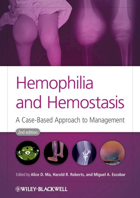 Hemophilia and Hemostasis(Kobo/電子書)