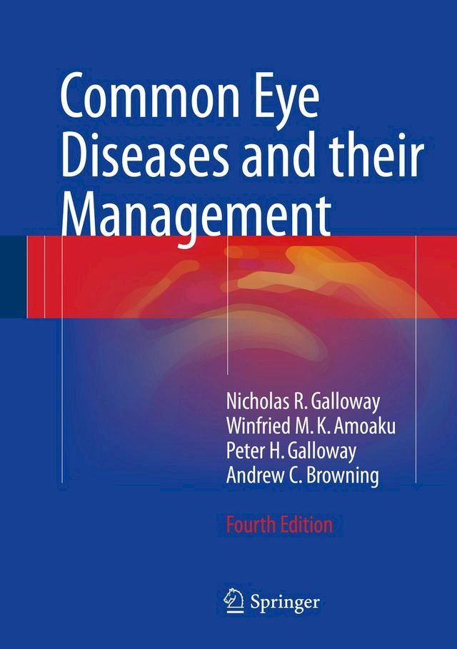  Common Eye Diseases and their Management(Kobo/電子書)